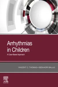 Arrhythmias in Children_cover