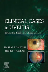 Clinical Cases in Uveitis E-Book_cover