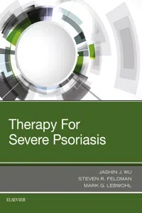Therapy for Severe Psoriasis E-Book_cover