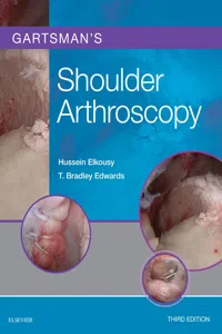 Gartsman's Shoulder Arthroscopy E-Book_cover