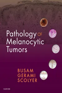 Pathology of Melanocytic Tumors E-Book_cover