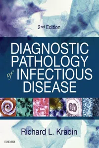 Diagnostic Pathology of Infectious Disease E-Book_cover