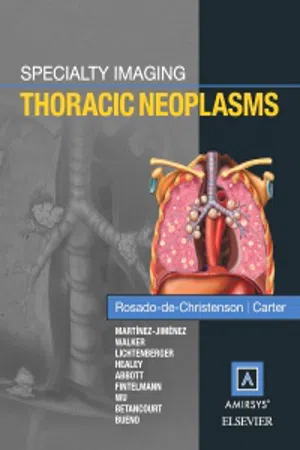 Specialty Imaging: Thoracic Neoplasms E-Book