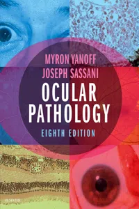 Ocular Pathology_cover