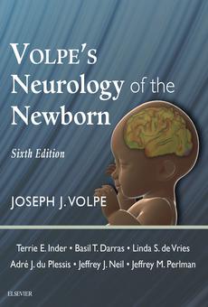 Neurology of the Newborn 英語版 PDF] Volpe's Neurology of the Newborn E-Book by Joseph J. Volpe