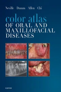 Color Atlas of Oral and Maxillofacial Diseases - E-Book_cover