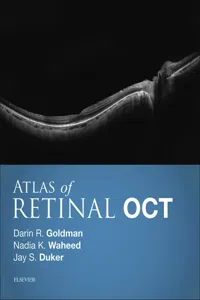 Atlas of Retinal OCT E-Book_cover