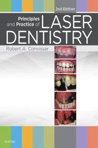 Principles and Practice of Laser Dentistry - E-Book_cover