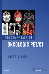 Fundamentals of Oncologic PET/CT E-Book_cover