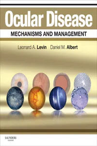 Ocular Disease: Mechanisms and Management E-Book_cover