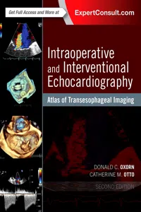 Intraoperative and Interventional Echocardiography_cover