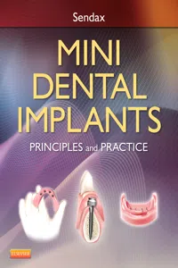 Mini Dental Implants_cover