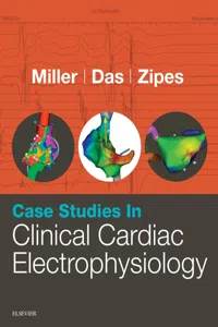 Case Studies in Clinical Cardiac Electrophysiology E-Book_cover