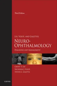 Liu, Volpe, and Galetta's Neuro-Ophthalmology E-Book_cover