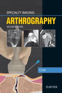 Specialty Imaging: Arthrography E-Book_cover