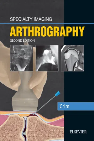 Specialty Imaging: Arthrography E-Book