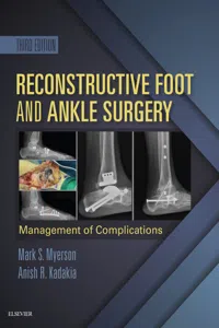 Reconstructive Foot and Ankle Surgery: Management of Complications E-Book_cover