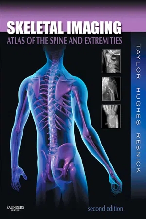 Skeletal Imaging