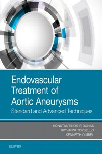 Endovascular Treatment of Aortic Aneurysms_cover