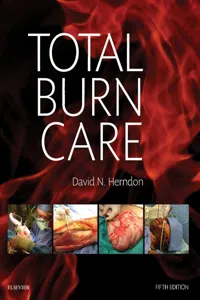 Total Burn Care E-Book_cover