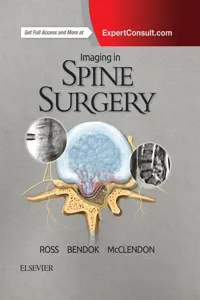 Imaging in Spine Surgery E-Book_cover