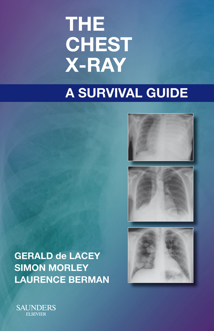 PDF] The Chest X-Ray: A Survival Guide by Gerald de Lacey