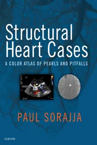 Structural Heart Cases E-Book_cover