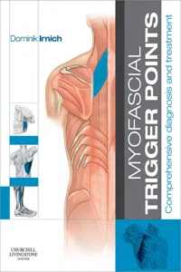 Myofascial Trigger Points_cover