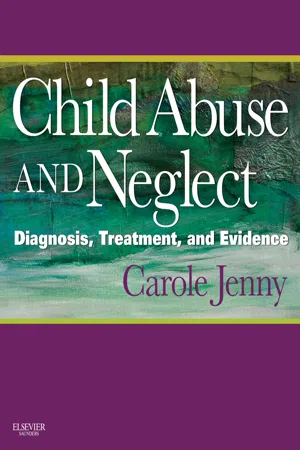 Child Abuse and Neglect E-Book