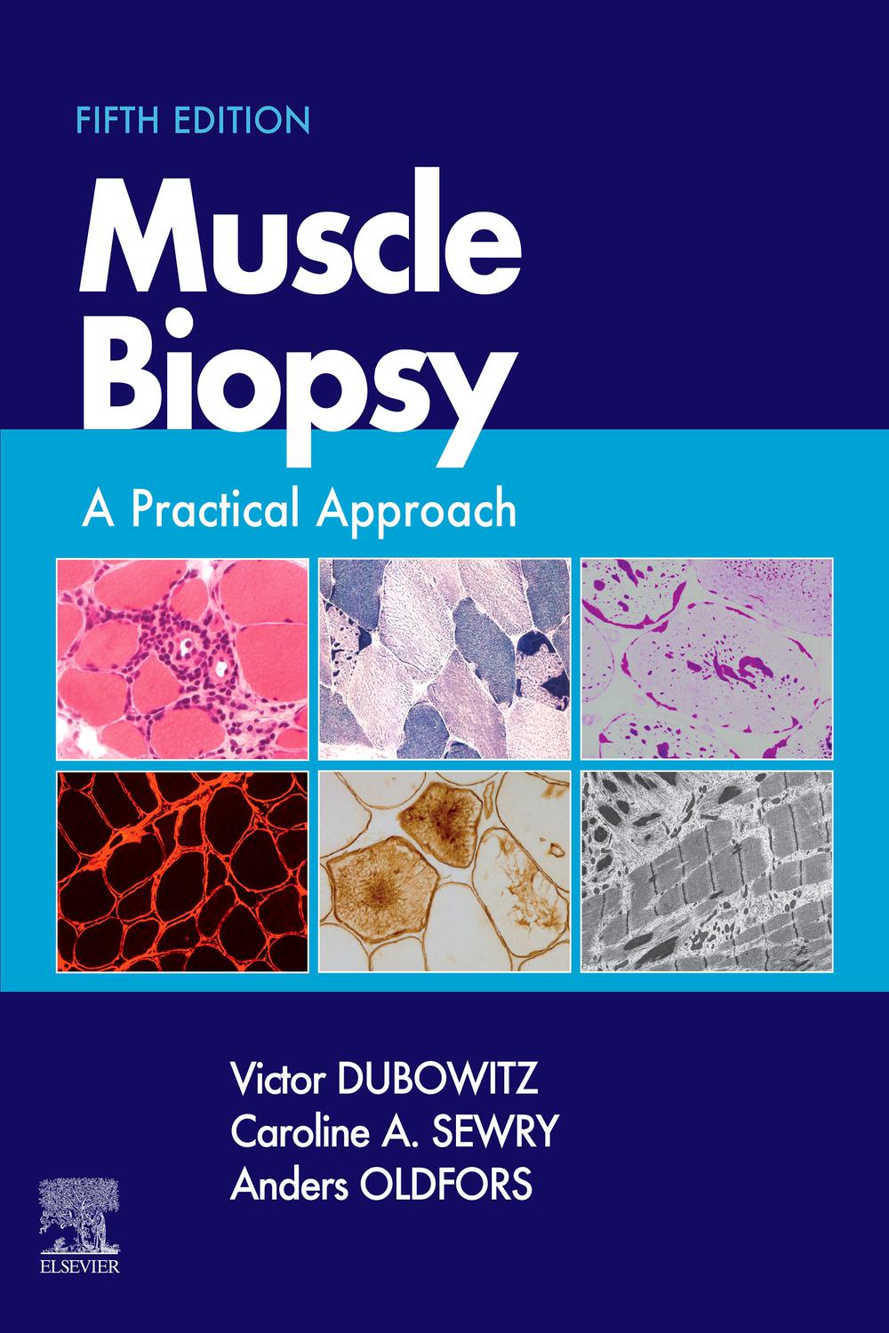 Muscle Biopsy: A Practical Approach 第5版 PDF] Muscle Biopsy E-Book by Victor Dubowitz, 5th edition