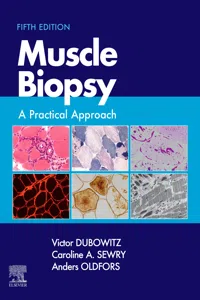Muscle Biopsy E-Book_cover
