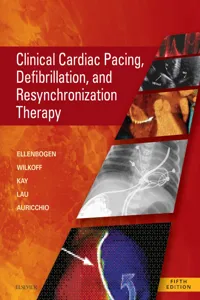 Clinical Cardiac Pacing, Defibrillation and Resynchronization Therapy_cover