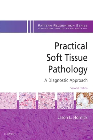 Practical Soft Tissue Pathology: A Diagnostic Approach E-Book