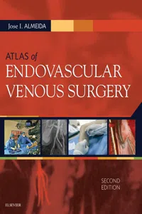 Atlas of Endovascular Venous Surgery E-Book_cover