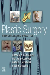 Plastic Surgery - Principles and Practice E-Book_cover