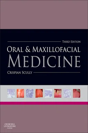 Oral and Maxillofacial Medicine