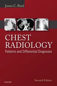 Chest Radiology: Patterns and Differential Diagnoses E-Book_cover