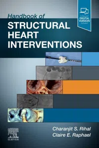 Handbook of Structural Heart Interventions, E-Book_cover