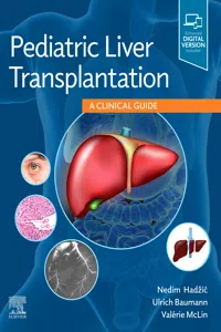 Pediatric Liver Transplantation_cover