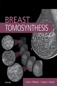 Breast Tomosynthesis E-Book_cover