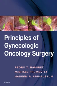 Principles of Gynecologic Oncology Surgery E-Book_cover