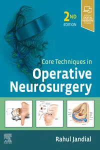 Core Techniques in Operative Neurosurgery E-Book_cover