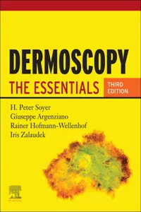 Dermoscopy_cover