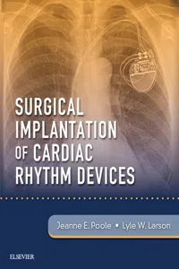 Surgical Implantation of Cardiac Rhythm Devices E-Book_cover