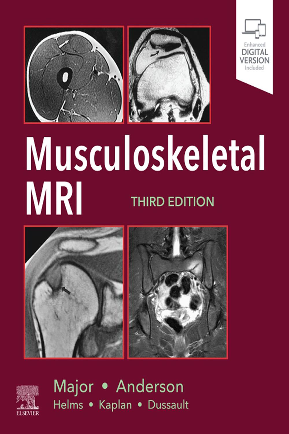 MRI In Orthopaedics And Sports 〜2冊 PDF] Musculoskeletal MRI E-Book by Nancy M. Major, 3rd edition