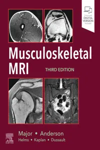Musculoskeletal MRI E-Book_cover