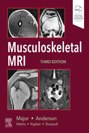 Musculoskeletal MRI E-Book