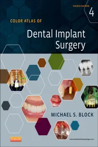 Color Atlas of Dental Implant Surgery - E-Book_cover