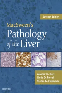 MacSween's Pathology of the Liver E-Book_cover