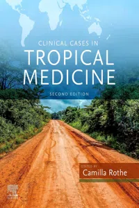Clinical Cases in Tropical Medicine E-Book_cover